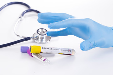 coronovirus, 2019 N-cov, epidemic disease, blood tubes