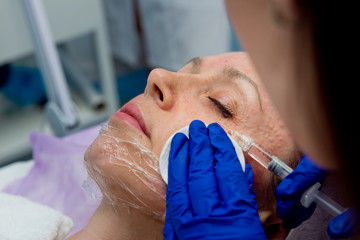 Hands of cosmetologist making injection in face. Close up.