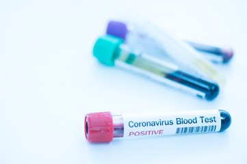 Blood test tube for laboratory analysis.Laboratory testing patient’s blood samples.Conceptual image coronavirus (COVID-19) test tube sample that has tested positive for coronavirus.