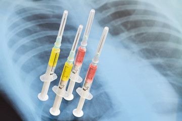 Syringes with various medicines on the background of lung x-ray photo. Pneumonia medication...