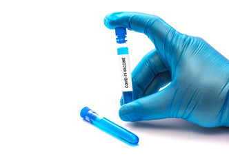 Coronavirus disease (COVID-19) outbreack. World pandemic. Global outbreak crisis