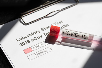 Laboratory Testing for nCovid-19 Corona Virus 2019-2020