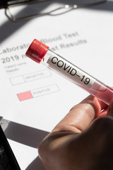 Laboratory Testing for nCovid-19 Corona Virus 2019-2020