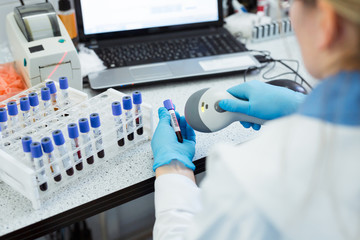 Bar codes scanner, blood sample tubes and laptop with lab technician hands on background....