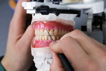 technician working on removable dental prostheses with pink gum