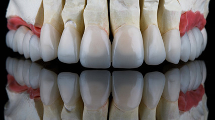 ceramic veneers and crowns of the upper jaw on a black background with a beautiful reflection on the glass © Dental Pro Content