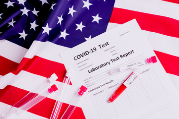 Laboratory test specialized in virus pandemics such as covid-19 studies blood of sick American patriots.