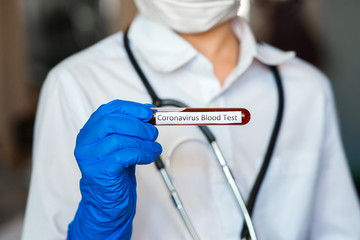 2019 nKoV coronavirus blood sample in doctor's hands. Crown virus outbreak. Epidemic Viral...