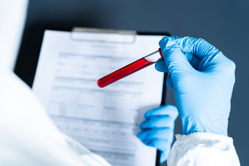 Conceptual photograph - Laboratory testing patient’s blood samples for presence of coronavirus (COVID-19)
