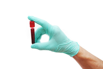 Hand of doctor holding blood sampling in laboratory