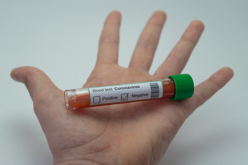 In the foreground a blood test of the coronavirus on top of an open hand.  The blood tube indicates negative to the 2019-NcOv.