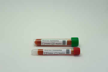 In the foreground two blood tests of the coronavirus.  One tube of blood is positive for 2019-NcOv...