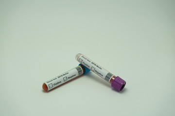 In the foreground two blood tests of the coronavirus.  One tube of blood is positive for 2019-NcOv...