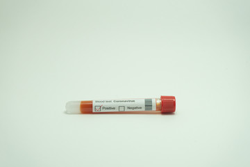 Coronavirus test tube.  Blood tests indicate that the patient has tested positive for 2019-NcOv.