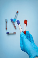 Laboratory doctor’s hand holding EDTA tubes filled with blood for the tests. Laboratory diagnostics. Hematology tests. 