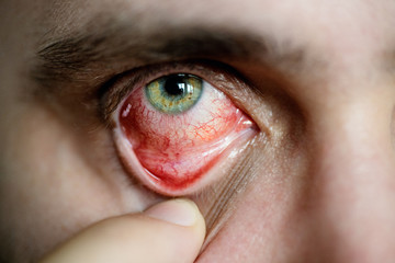 Obraz premium Closeup red eye