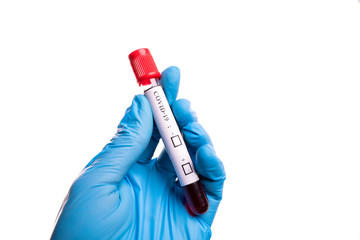 Naklejka premium blood sample tube Coronavirus,Covid-19 In the hand, Putts wore blue protective gloves.Isolated on white background
