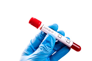 Fototapeta premium blood sample tube Coronavirus,Covid-19 In the hand, Putts wore blue protective gloves.Isolated on white background