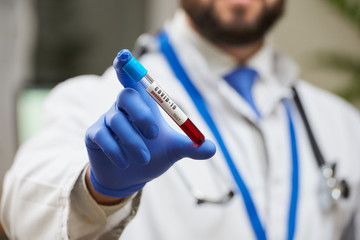 An infectious disease physician with a beard demonstrating a coronavirus blood tube test in his hand. A close-up photo of a positive COVID-19 blood sample.