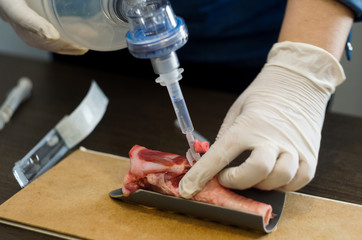 Medical exercise from reanimation. Intubation through the trachea