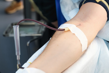 Close up arm of a man who donates blood. Male donor gives blood in a mobile blood donation center....