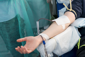 Close up arm of a man who donates blood. Male donor gives blood in a mobile blood donation center....