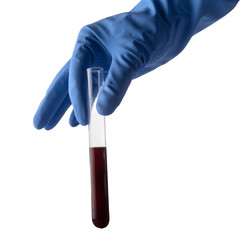 Test tube with blood in hands