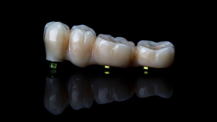 beautiful bridge of the chewing part, shot on a black background with reflection