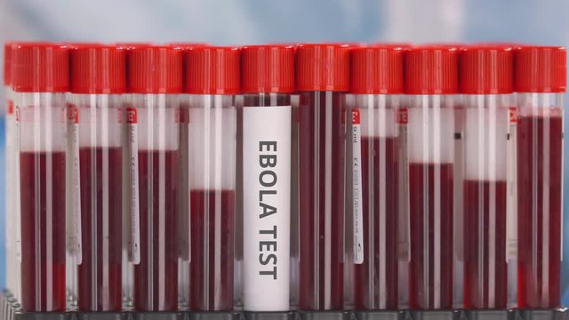 Laboratory worker wearing protection glove puts laboratory tube with ebola test in the tube rack