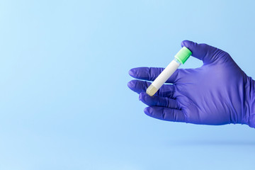 test tube in hand of lab technician