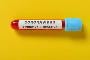 a coronavirus blood test tube with result of positive on yellow background the X has clipping path and can be removed