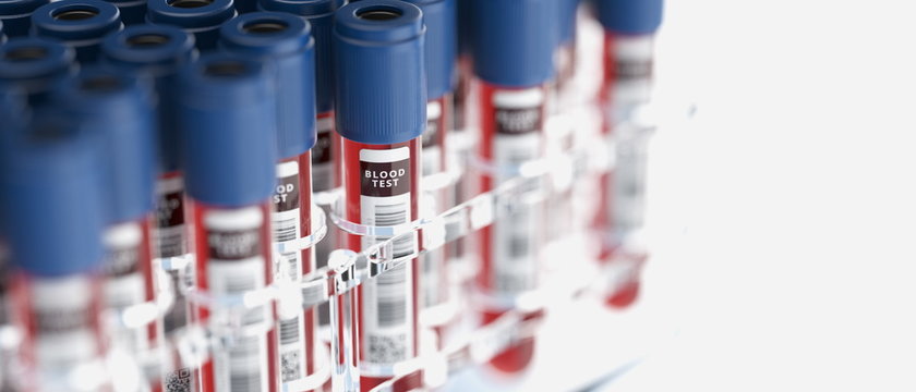 Blood test tubes in plexiglass container