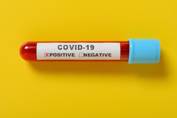 a covid-19 blood test tube with result of positive on yellow background the X has clipping path and can be removed