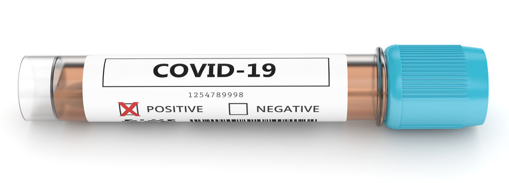 3d render of covid-19 positive nasal swab laboratory test