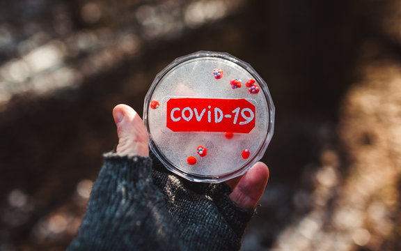 sample of coronavirus in vitro