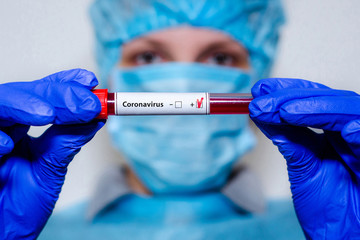 Medical laboratory assistant holding test tube with positive Coronavirus test blood sample.