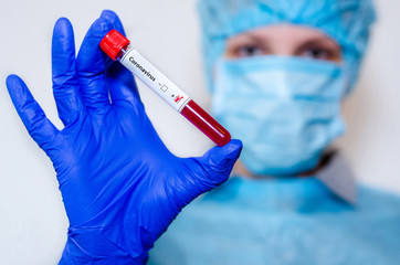 Medical laboratory assistant holding test tube with positive Coronavirus test blood sample.