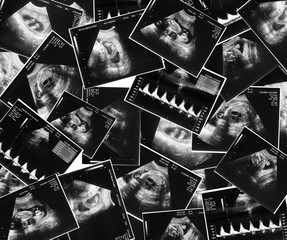 ultrasound picture of a child