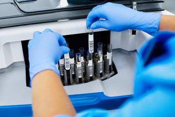 close-up of medical scientist in blue disposable gloves holding samples with reagents at laboratory