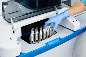 scientist arm in blue disposable glove touching test tubes from laboratory machine