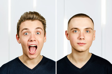 person before arter haircut with hair loss: bald and pompadour, transplant and transformation