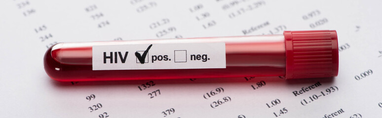 positive hiv blood sample test on paper result form, panoramic shot