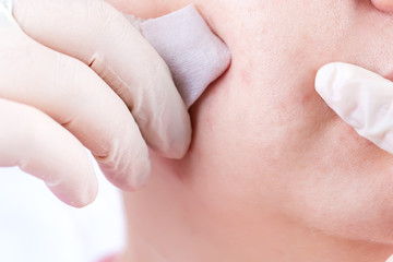 Naklejka premium Woman's face of skin blemish and hands in rubber gloves with cleaning sponge, close-up view of skin face's problem.