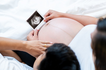 Pregnant woman and her hasband are looking at the ultrasound film together.  Concept of happy family and good quality of life.  Pregnant woman background.