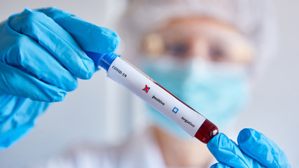 Blutprobe im Labor positiv auf Covid-19 Test