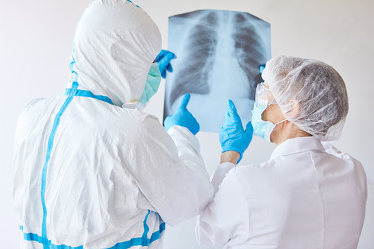 Ärzte untersuchen Röntgenbild auf Lungenentzündung