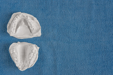 Two white cast of crooked teeth on a blue textural background, made by a child before installing...