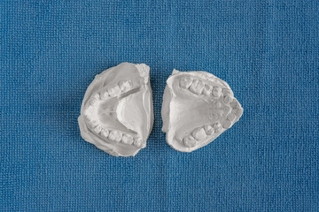 Two white cast of crooked teeth close-up on a blue textural background, made by a child before installing braces. Located near the center.