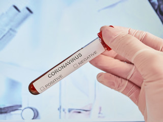 Coronavirus 2019-nCoV Blood Test. Corona virus. China virus