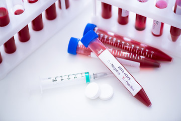 Test tube with blood sample for COVID-19 test, novel coronavirus 2019. Concept of vaccination,...